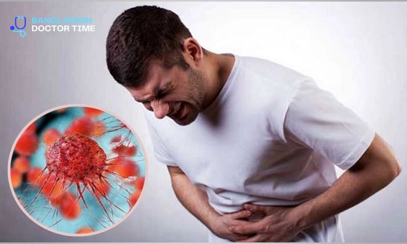 Best cancer Specialist in  Dhaka