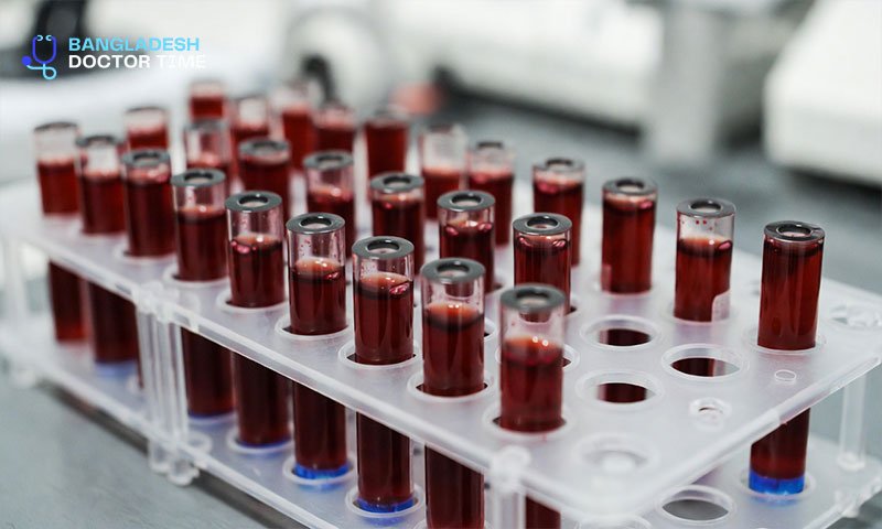 CBC Test Price in Bangladesh