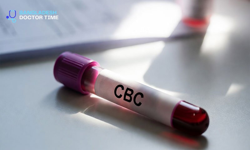 CBC Test Price in Bangladesh