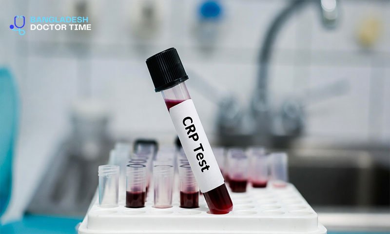 CRP Test Price in Bangladesh
