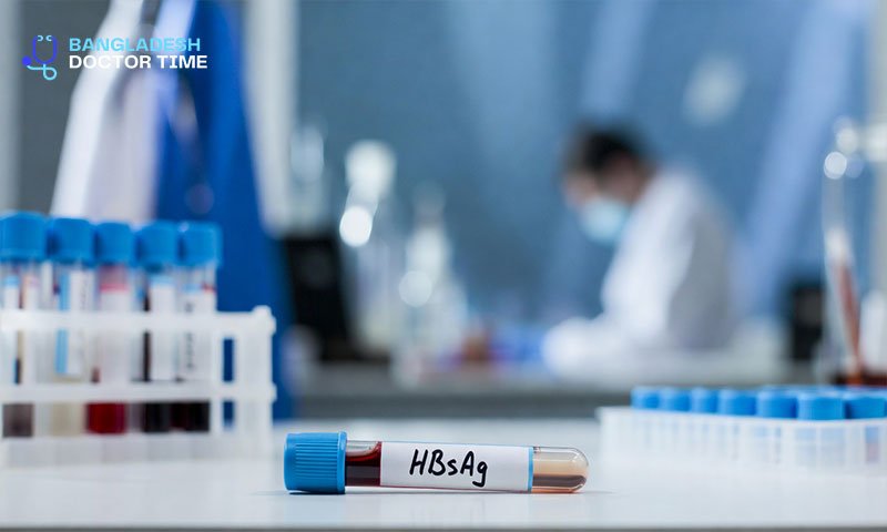 HBSAG Test Price in Bangladesh