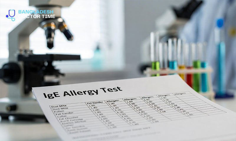 IGE Test Price In Bangladesh