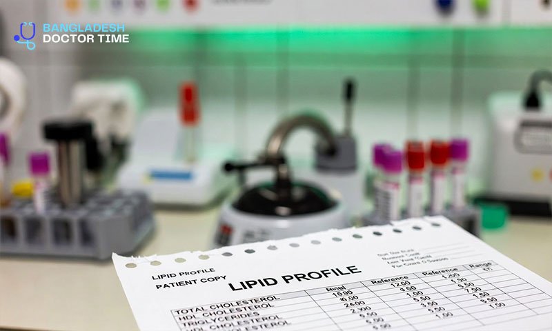 LIPID Test Price In Bangladesh