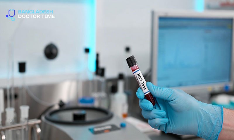 RBS Test Price in Bangladesh