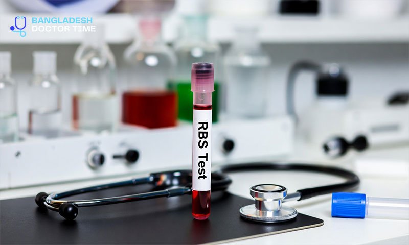 RBS Test Price in Bangladesh