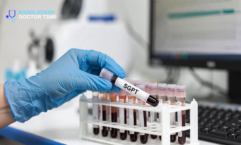 SGPT Test Price in Bangladesh