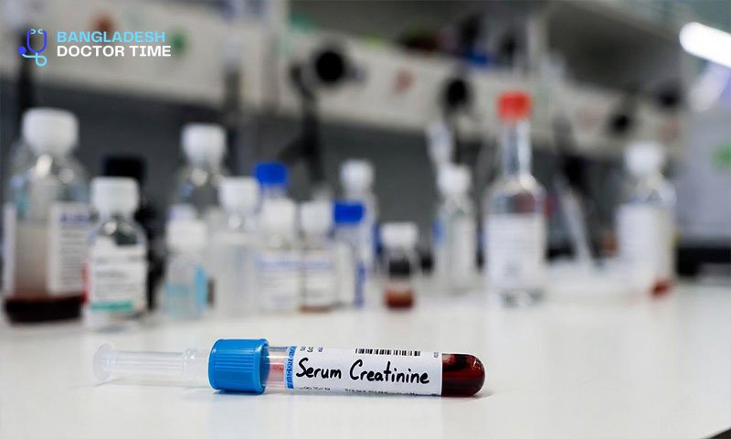 Serum Creatinine Test Price in Bangladesh
