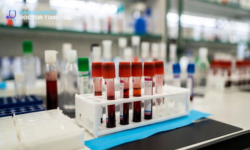 TSH Test Price in Bangladesh