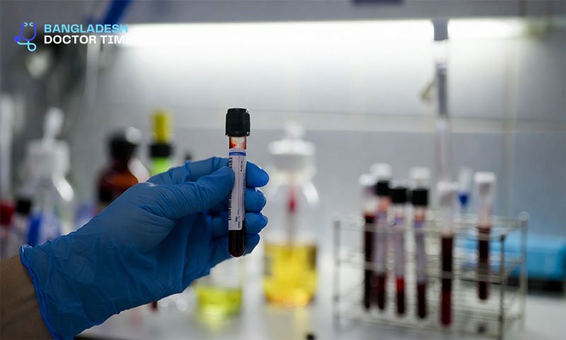 TSH Test Price in Bangladesh