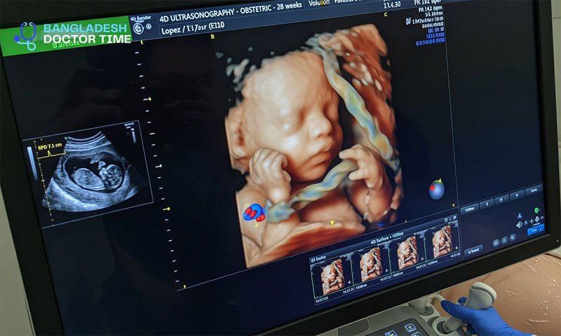 4D ULTRASONOGRAPHY Test Price In Bangladesh