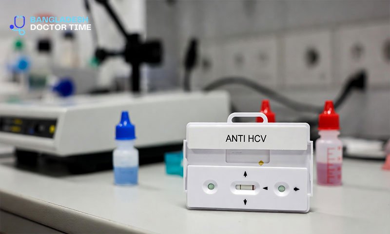 ANTI HCV Test Price In Bangladesh