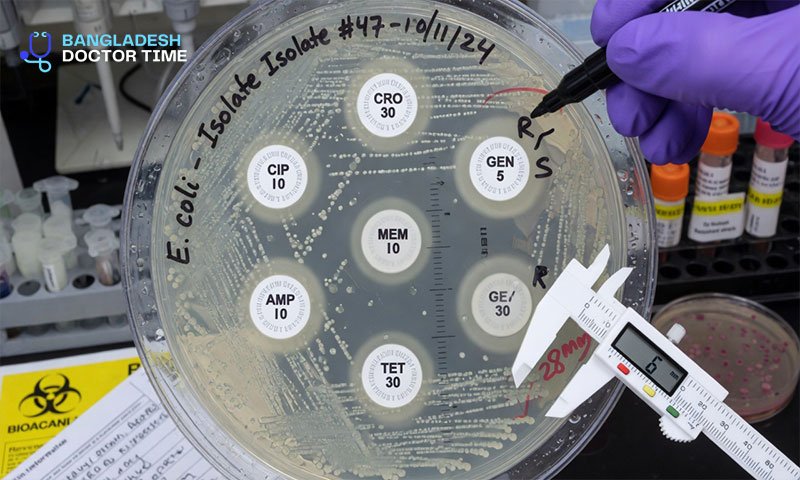 Antibiotic Resistance Test Price In Bangladesh