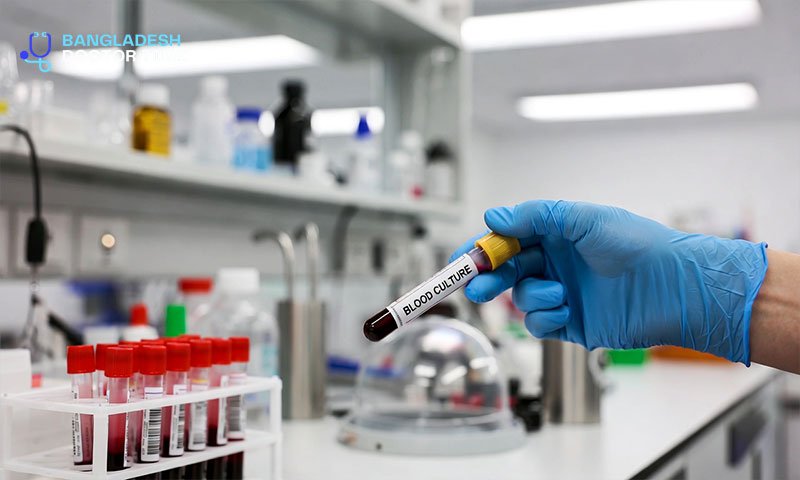 BLOOD CULTURE Test Price In Bangladesh