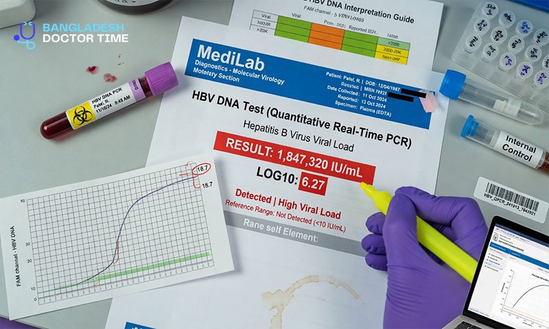 HBV DNA Test Price In Bangladesh