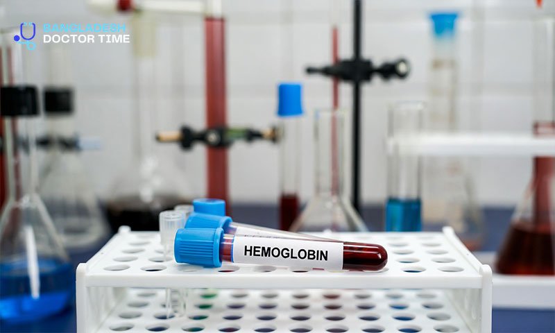 HEMOGLOBIN Test Price In Bangladesh