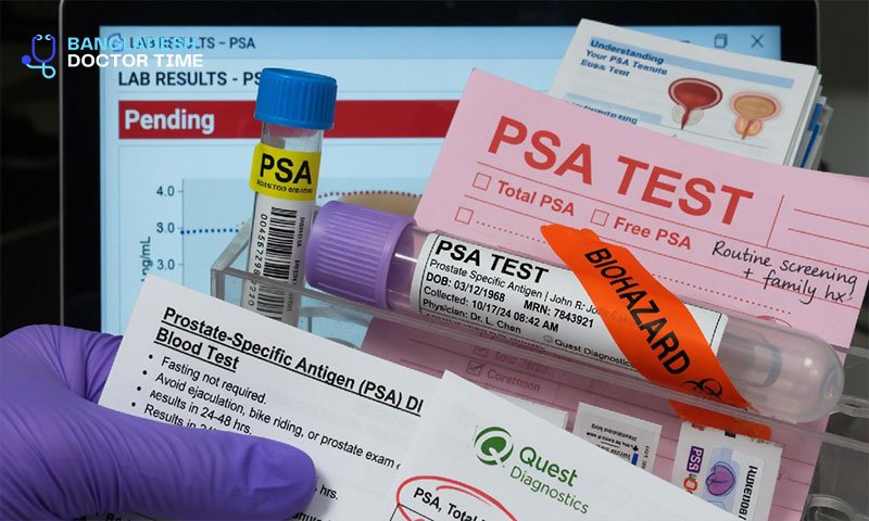 PSA Test Price In Bangladesh