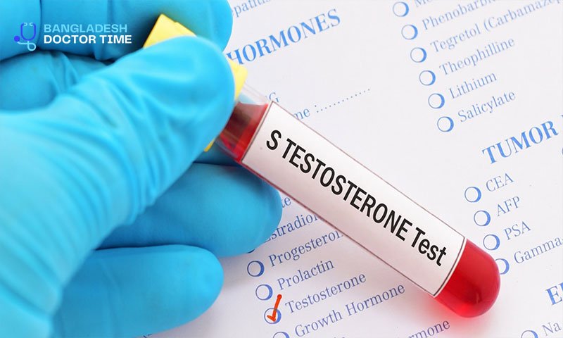 S TESTOSTERONE Test Price In Bangladesh