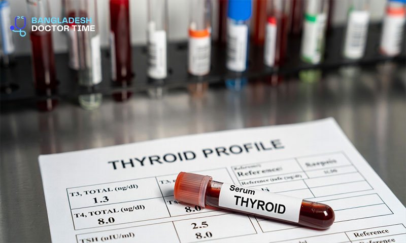 THYROID Test Price In Bangladesh