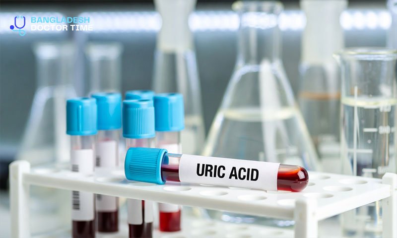 URIC ACID Test Price In Bangladesh