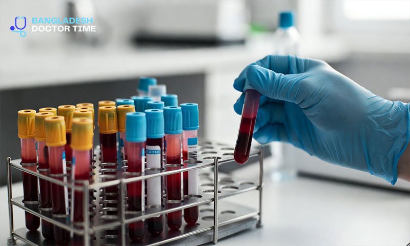 VDRL Test Price In Bangladesh​